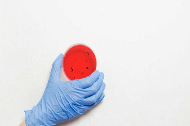 New findings on bacteria that increase risk of pancreatic cancer