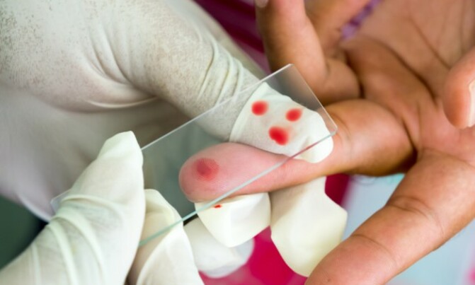 Malaria funding to the region drops by over $6m -WHO report Malaria funding to the region drops by over $6m -WHO report
