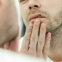 Could cold sores increase the risk of Alzheimer's disease? A new study is no cause for panic