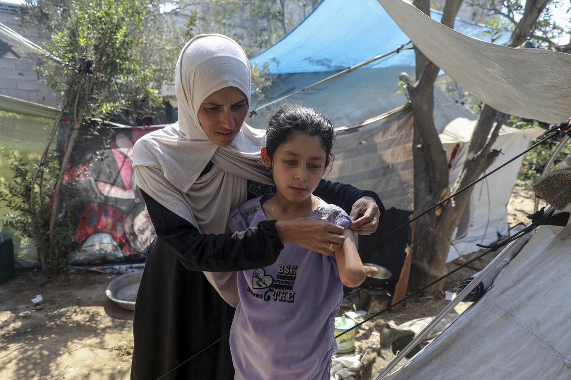 MIDEAST-GAZA CITY-AMPUTEE-CHILD-WAR