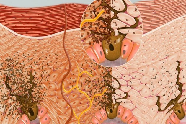 Here is how sun damages our skin: study