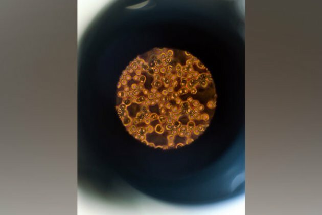 Droplets of fat fights back against infections, finds study