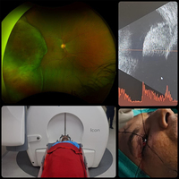 Army Hospital performs Gamma Knife Therapy on 38-year-old serving officer