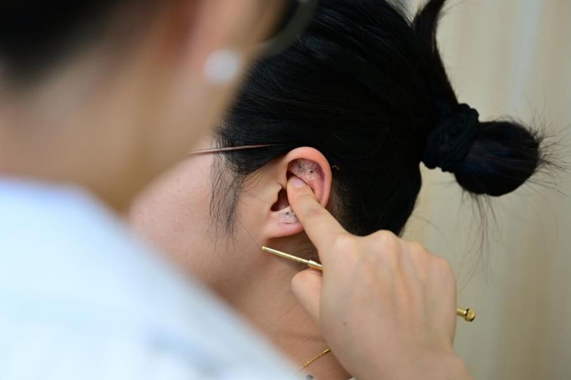 GLOBALink | China's Huangshan City lures 2.7 million tourists with ancient healing traditions