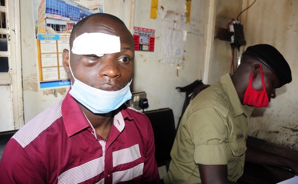 Mwesigwa eyagudde mu bazigu mu Kampala ne bamukuba ne bamubbako n'essimu Mwesigwa eyagudde mu bazigu mu Kampala ne bamukuba ne bamubbako n'essimu