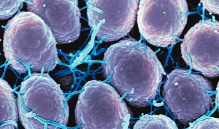 (c) National Institute of Allergy and Infectious Diseases 