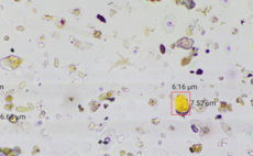 Can agri tech cut fungicide costs without hitting yield?