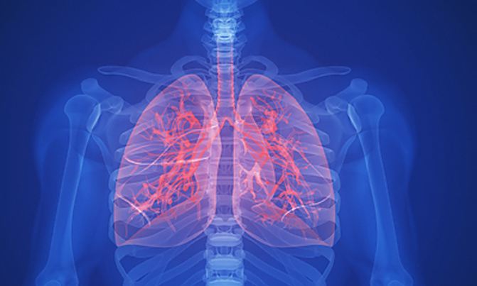 Two lung diseases killed 3.6 million in 2015: study Two lung diseases killed 3.6 million in 2015: study