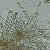 White mold fungi split their genome across several nuclei, with implications for future gene editing