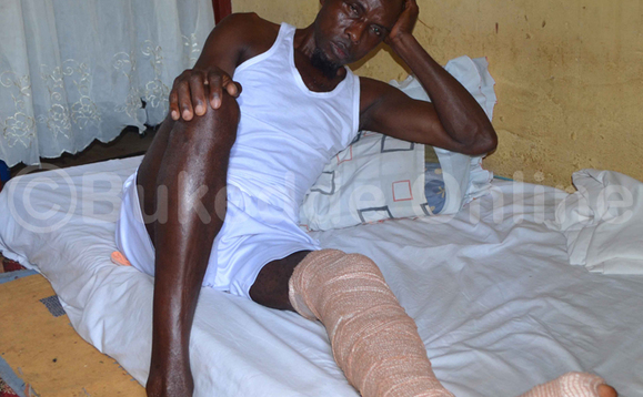 Ssekatawa ng'ali mu makaage e Namasuba afa obulumi bw'ekiwundu ky'okugulu Ssekatawa ng'ali mu makaage e Namasuba afa obulumi bw'ekiwundu ky'okugulu