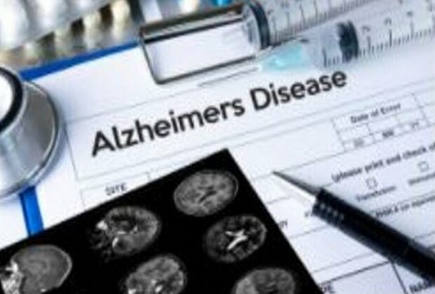 Potential Alzheimer's disease therapy developed