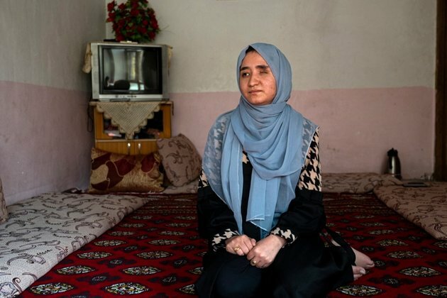 US Campaigners Raise Funds for Afghan Blast Survivor