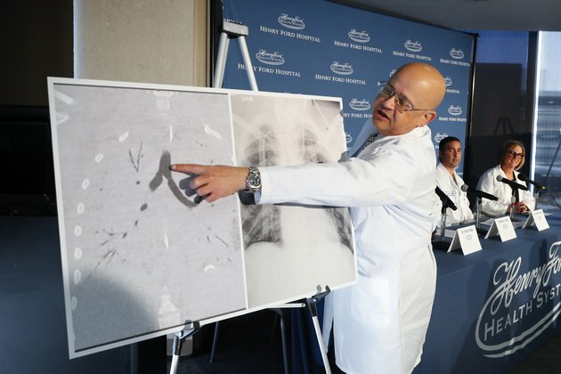 Michigan Teen Who Vaped Received Double Lung Transplant
