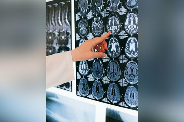 Study suggests brief exposure to air pollution has rapid impacts on brain