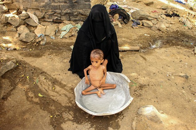 Money Pledged for Yemen But Not Paid Could Cost Lives