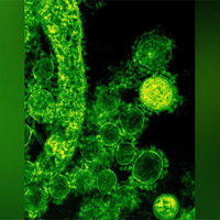 Nipah virus alert issued in three Kerala districts after two suspected cases