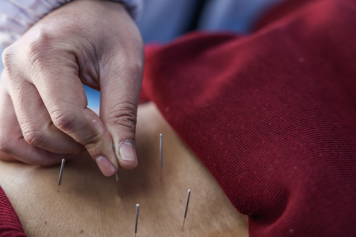 CHINA-ZHEJIANG-ZHUJI-TRADITIONAL CHINESE MEDICINE-SERVICE (CN)
