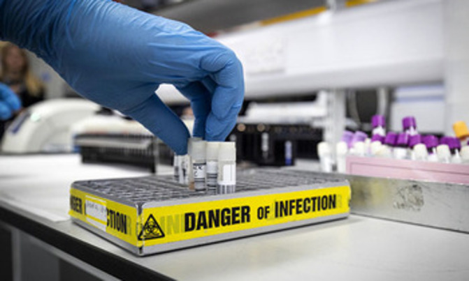 Ivory Coast confirms first coronavirus case Ivory Coast confirms first coronavirus case