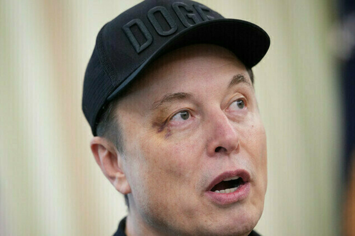Musk explains his black eye