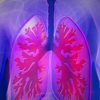 Pakistan: Karachi faces alarming rise in respiratory diseases