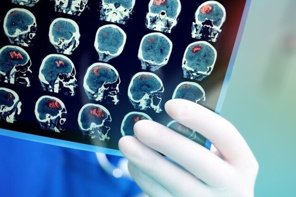 Arkansans encouraged to know stroke risks