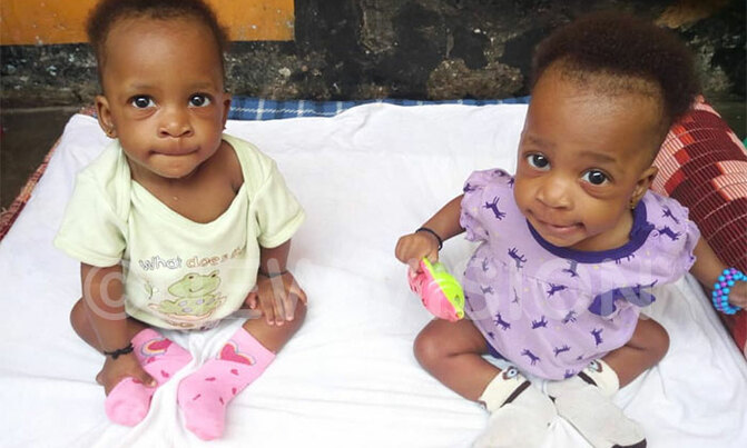 After 10 months, I gave birth to twins After 10 months, I gave birth to twins