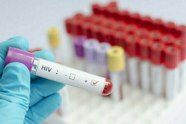 Funding cuts threaten HIV response efforts in South Africa