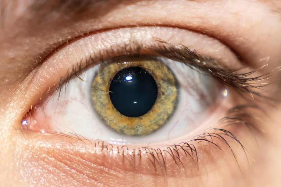 The subtle clue in your EYE that could mean you'll get dementia as young as 45