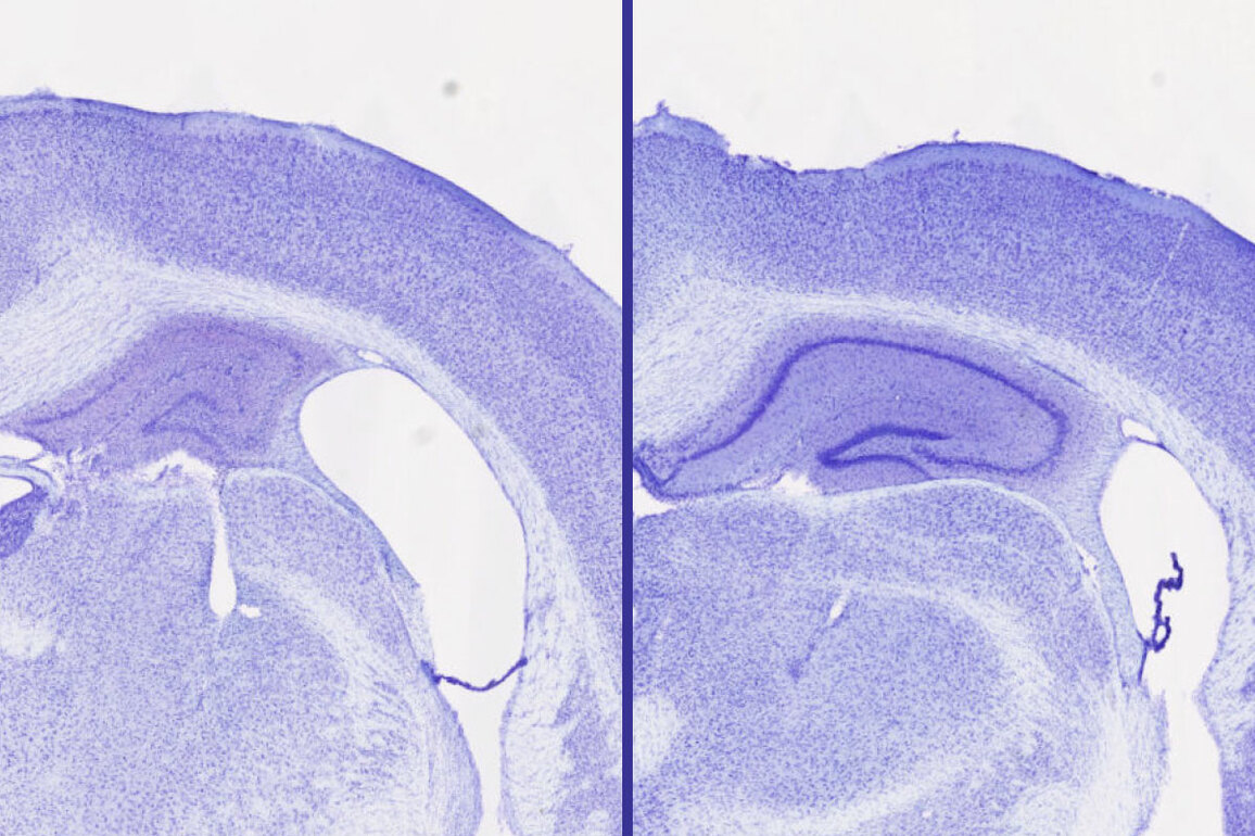 Sleep aid blocks neurodegeneration in mice - The Source - WashU