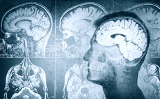 Ysios, Omega lead €15m series-A for Anaconda Biomed