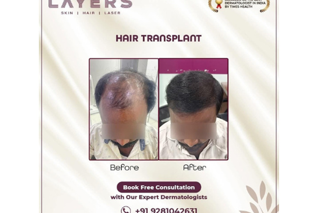 Rapid Nationwide Expansion: Layers Skin and Hair Clinics Continues to Sculpt Beauty Inside and Out