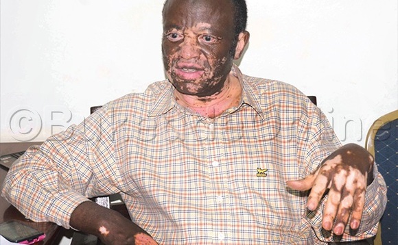 James Mugala bw’afaanana. Wano ng’aliko by’annyonnyola. James Mugala bw’afaanana. Wano ng’aliko by’annyonnyola.