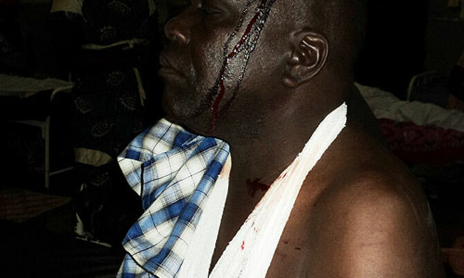 Ngora road accident kills 4 Ngora road accident kills 4