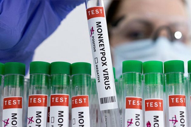 Mainland China reports first monkeypox case in Chongqing city