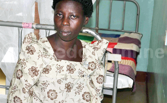 Musumika yawonyezebwa obulwadde bwa fisitula. Musumika yawonyezebwa obulwadde bwa fisitula.