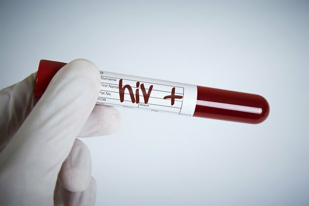 EU regulator greenlights first injectable HIV drug