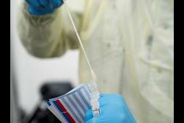 One more tests positive for COVID-19 in Bihar, tally 39