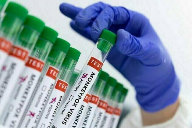 Ghana reported 45 confirmed cases of monkeypox in past month