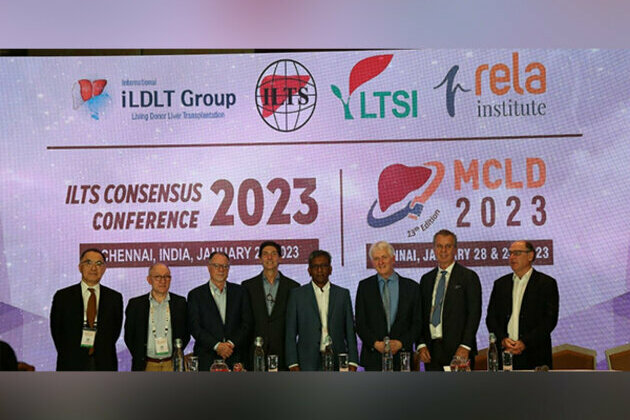 Rela Hospital conducts Asia's first Consensus Conference on Management of Patients who receive Small Liver Graft
