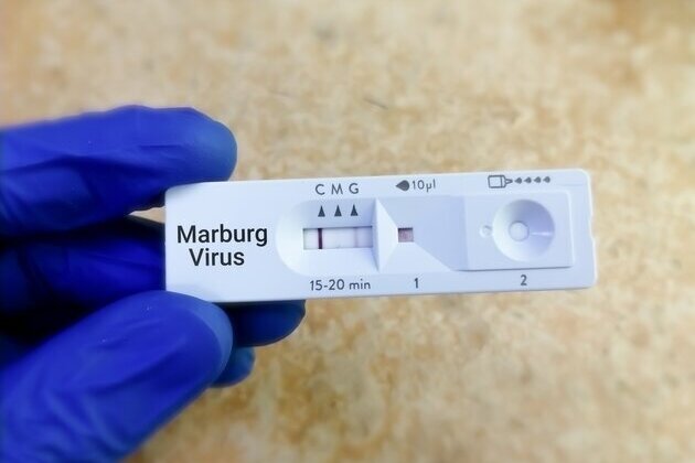 Ethiopia declares end of Marburg virus disease outbreak