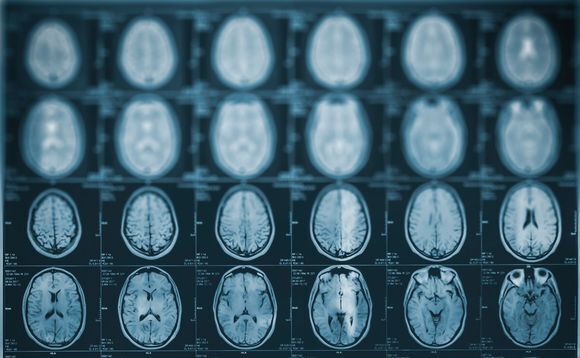 Horizons leads Series B for Australia healthcare AI start-up  