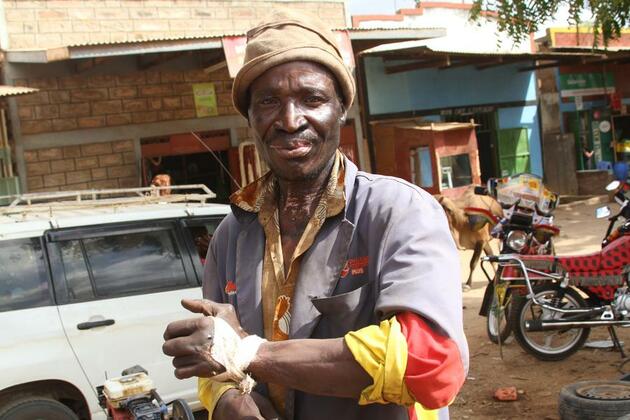 Kenya battles rising snakebite cases as climate change drives snakes closer to humans