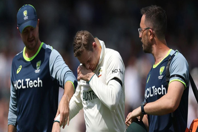 "Little bit of wait and see...": Cummins provides update on Steve Smith's injury