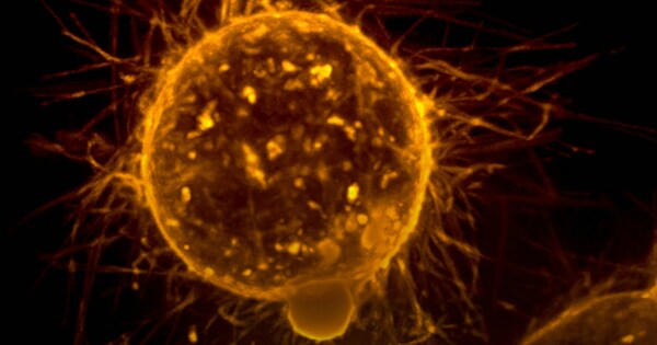 Thousands of men invited to early protection prostate cancer study