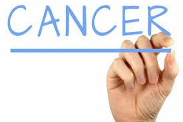 Big data powers design of 'smart' cell therapies for cancer