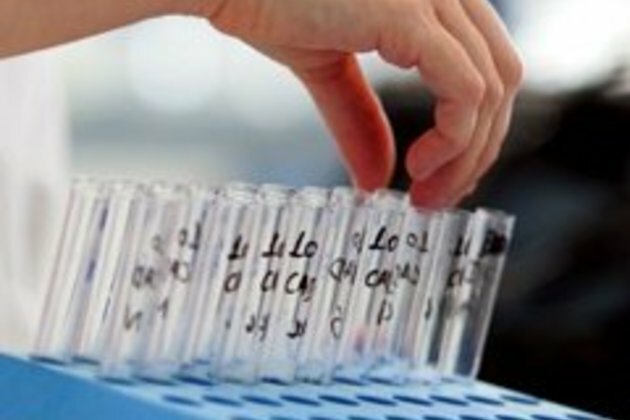 French steeplechaser reportedly fails doping test