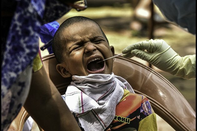 Opinion: Stronger global poverty reduction efforts needed amid pandemic