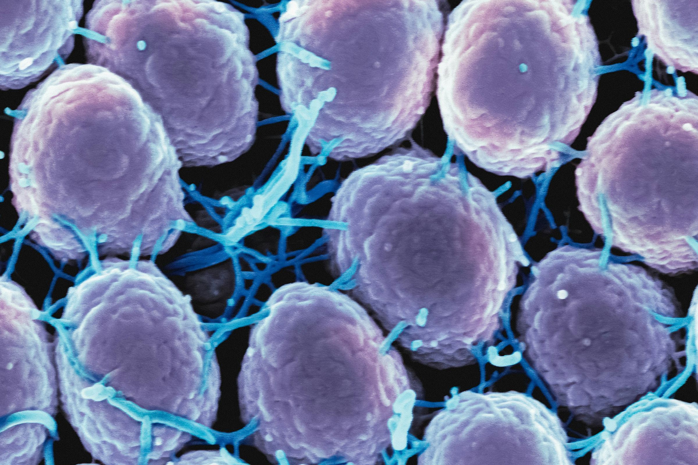 NHS and local government partner on gonorrhoea vaccine