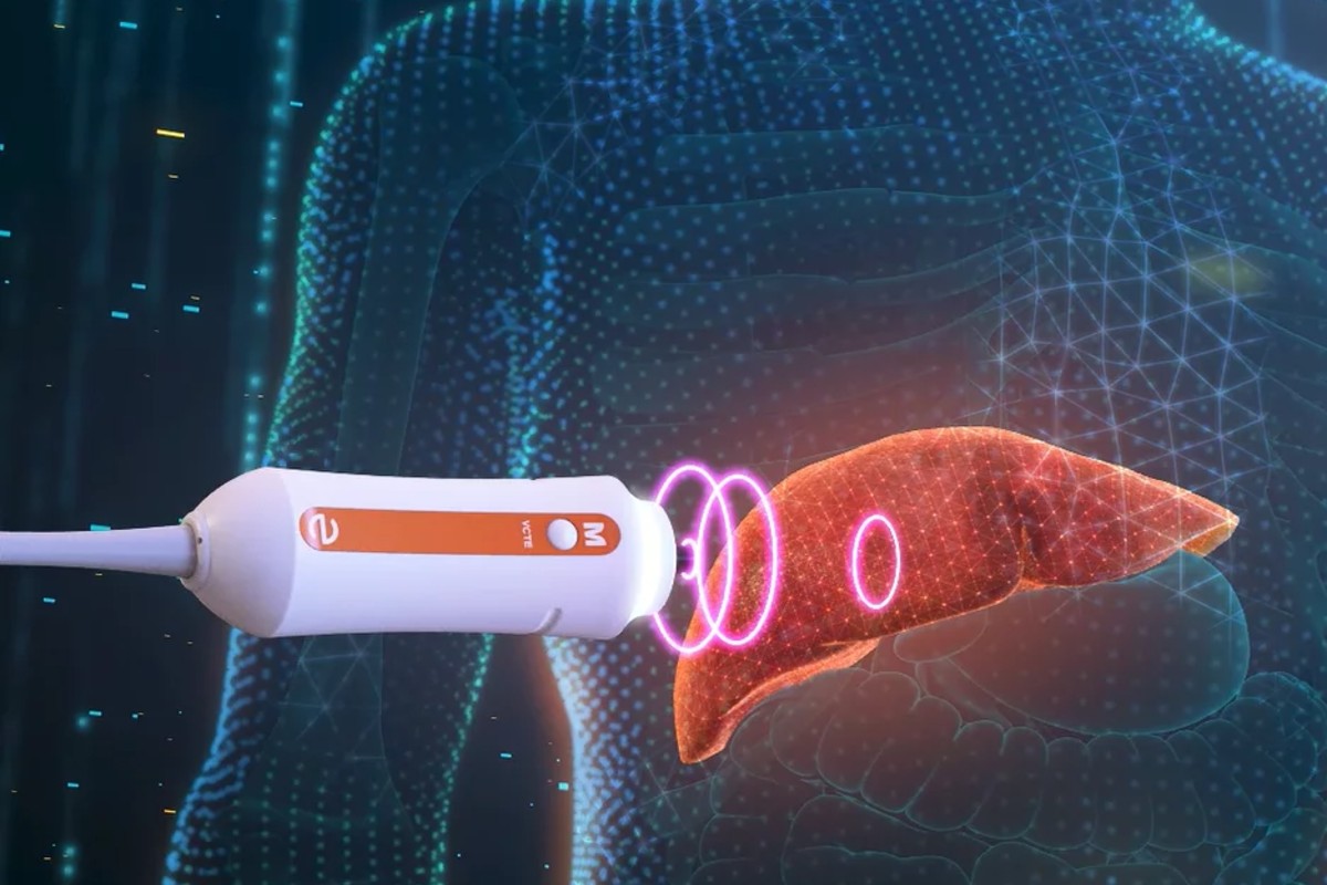 NHS scanning trucks help thousands get liver cancer checks