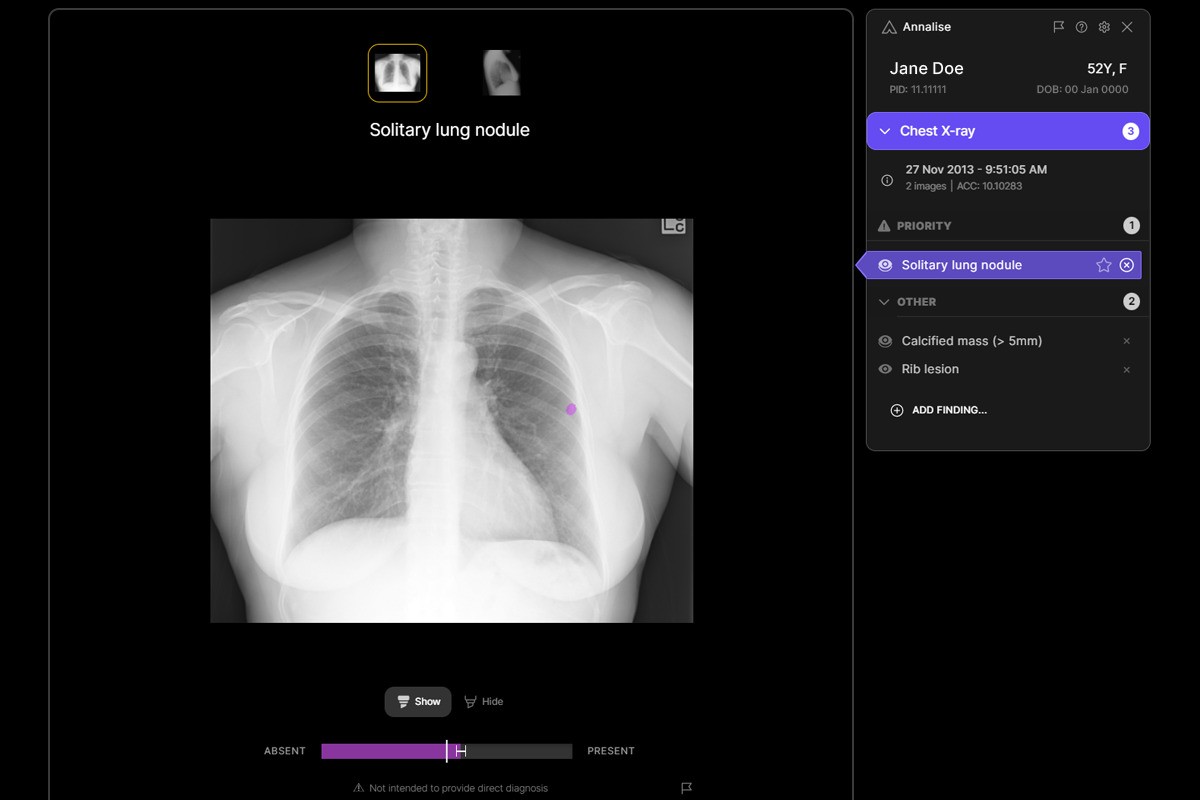 Greater Manchester trust launches AI solution to diagnose lung cancer quicker